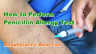 Penicillin G Allergy Test | Benzylpenicillin | Type 1 Hypersensitivity Reaction | How to Do