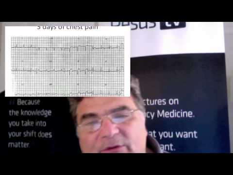 ECG in 20 Seconds