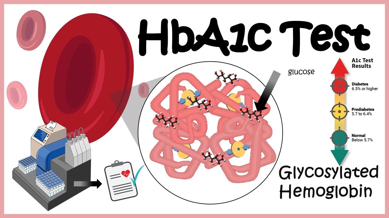 HbA1c Test ( Glycosylation of haemoglobin) | Diabetes