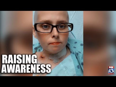 TIKTOK HELP: Mid-South woman with rare form of breast cancer takes to TikTok to raise awareness