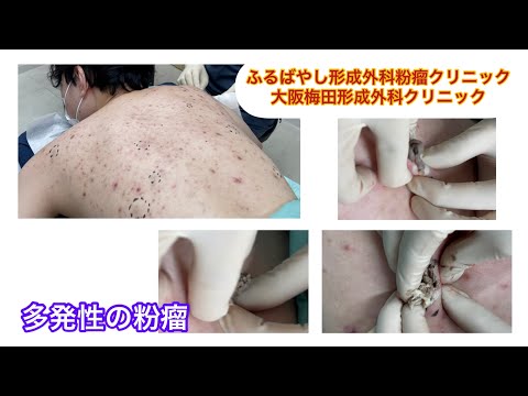 無視できる集合について詳しく解説