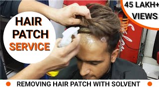 Hair patch Service for Men  Hair Wig Service in De
