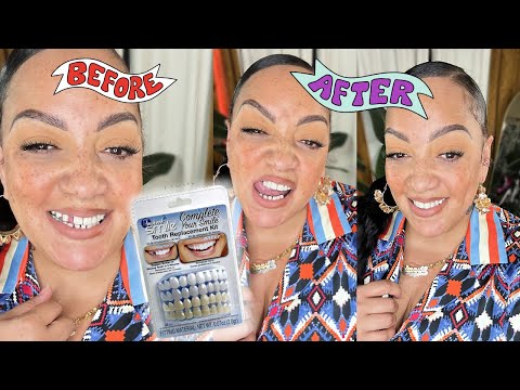 I Bought a Tooth from Amazon! How I Fixed My Missing Front Tooth It Looks So Real!