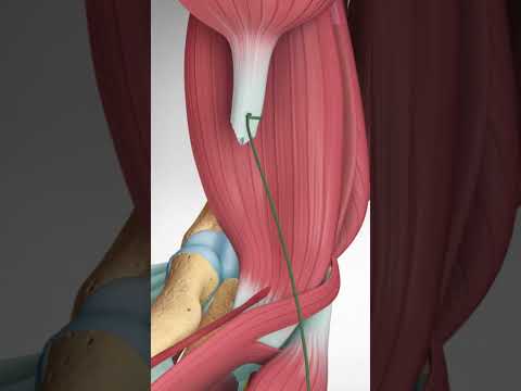 Guess The Spine Injury And Procedure Challenge