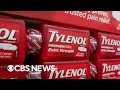 Study Finds No Link Between Tylenol Use During Pregnancy And Autism ADHD