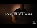 Scars On His Hands 