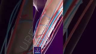 Erectile Dysfunction Treatment by Shockwave Therapy #shorts