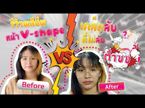 เมโสแฟต ยี่ห้อไหนดี