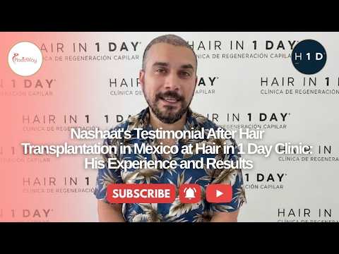 Nashaat's Testimonial after Hair Transplantation in Mexico by Hair in 1 Day Clinic