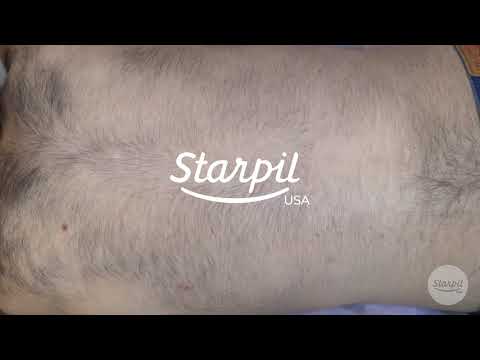 How to Wax Men's Back Hair - Full Back Hair Removal - Starpil Wax