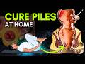 Piles Problem Treatment Part 1 Yoga For Piles Cure Hemorrhoids With Simple Exercises Piles