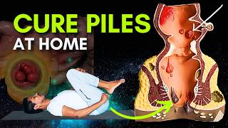 Piles Problem Treatment | Yoga for Piles | Cure Hemorrhoids with Simple Exercises #piles