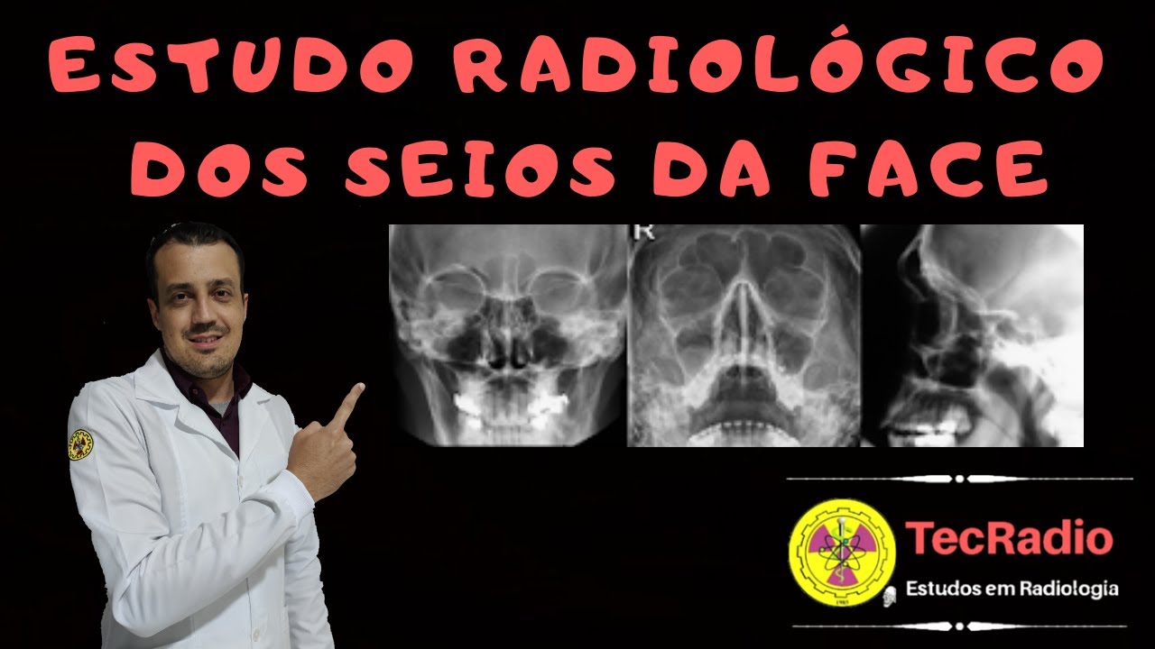 ESTUDO RADIOLÓGICO DOS SEIOS DA FACE