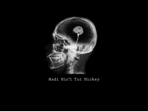 Mirac - Hadi Mic'i Tut Mickey | (Ati242 Re-Diss)