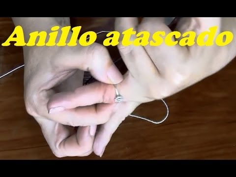 RING GET STUCK. SACAR ANILLO ATASCADO