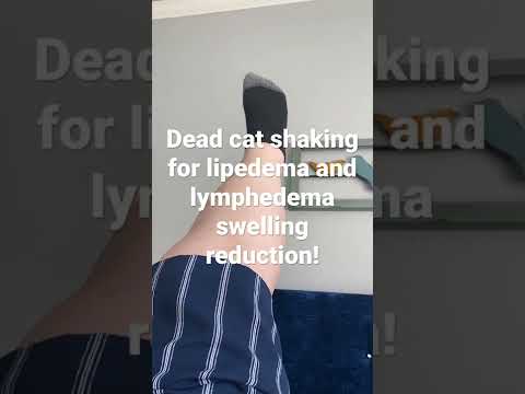 How to Do a Simple, Dead Cat Shake for Lipedema and Lymphedema Swelling Reduction
