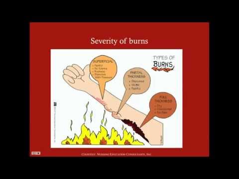 Introduction to Burns - CRASH! Medical Review Series