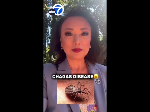 Chagas disease from 'kissing bugs' found in SoCal