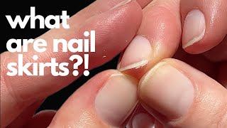 How to get rid of nail "skirts".