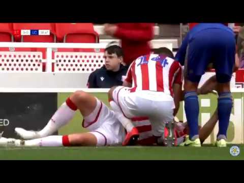 Ryan Shawcross Leg Break Stoke City vs Leicester 2019