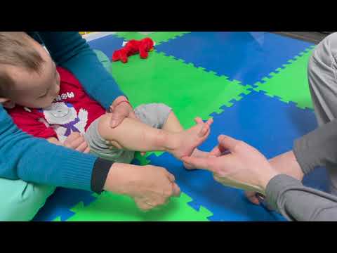 Babinsky reflex,  Maria Teresa Ferrer, Dr in Physical therapy. MTF Program, and Intensive therapy.