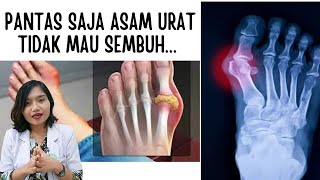 Download lagu 3 PENYEBAB ASAM URAT SULIT SEMBUH DAN SOLUSINYA | dr.Emasuperr mp3