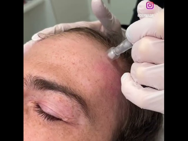 Derma SR Hair Vitalizer Serum