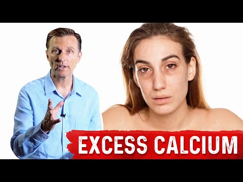 Serious Excess Calcium Side Effects (Soft-Tissue Calcium) – Dr.Berg