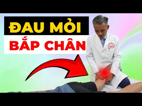 Bắp Chân Đau Mỏi Không Đỡ? Phương Pháp Giúp Bạn Thoát Khỏi Cơn Đau