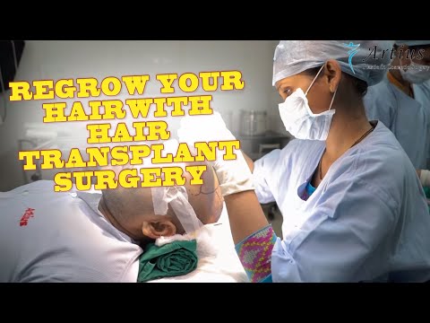 download lagu mp3 mp4 Hair Doctor In Navi Mumbai, download lagu Hair Doctor In Navi Mumbai gratis, unduh video klip Hair Doctor In Navi Mumbai