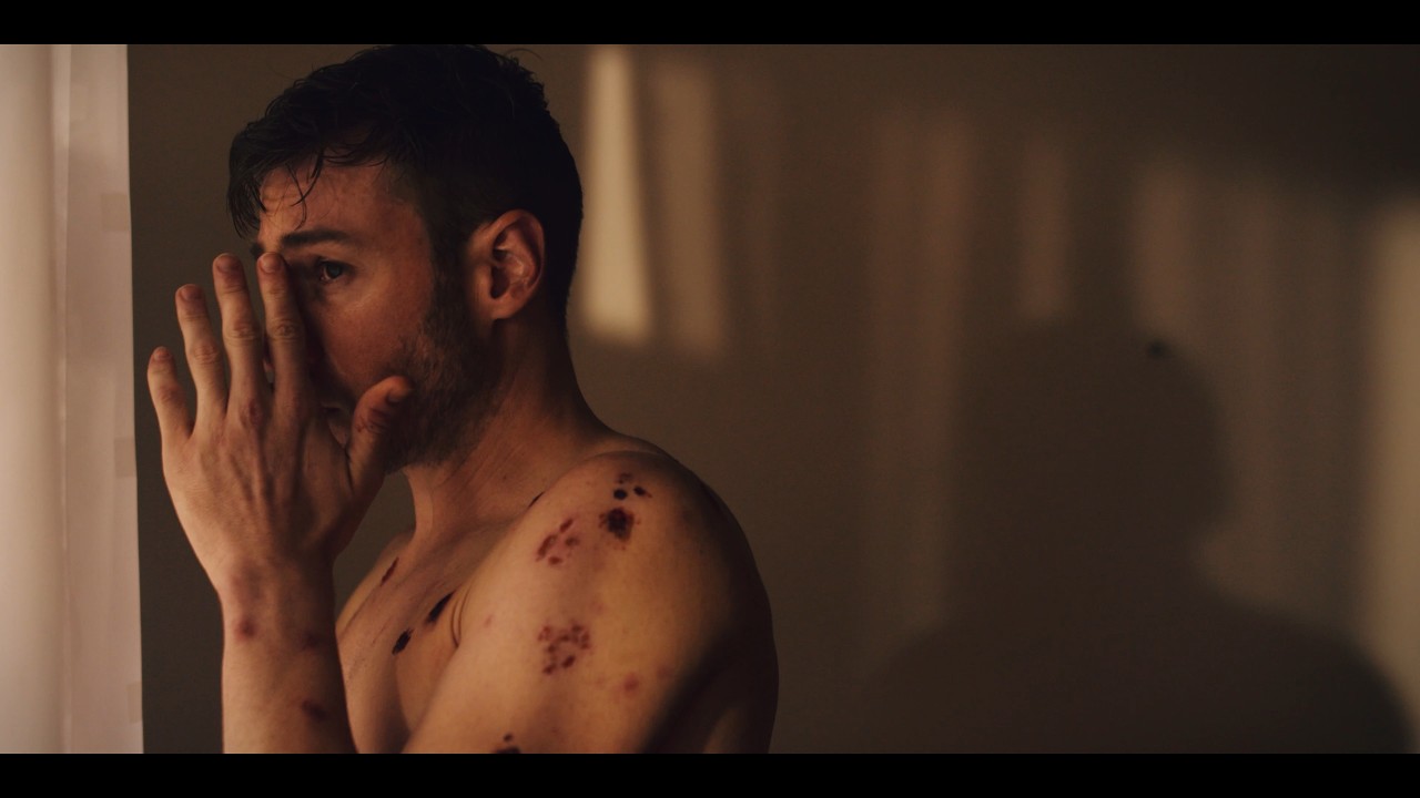 SCAB | Official Teaser | Body Horror