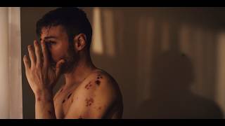 SCAB | Official Teaser | Body Horror