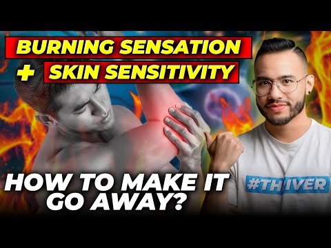 Watch on YouTube: Why Your Skin Burns, Tingles, and Hurts to Touch