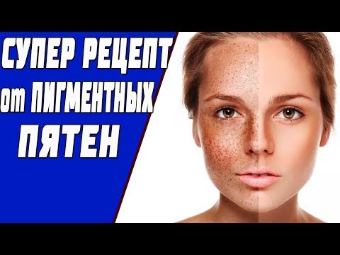 Крем отбеливающий увлажняющий отзыв Пигментация на лице к какому врачу обратится