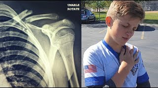 Nephew Breaks Collarbone Playing Soccer - Jordan