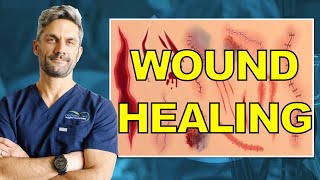 4 fasi della guarigione delle ferite: dal sanguinamento alla guarigione