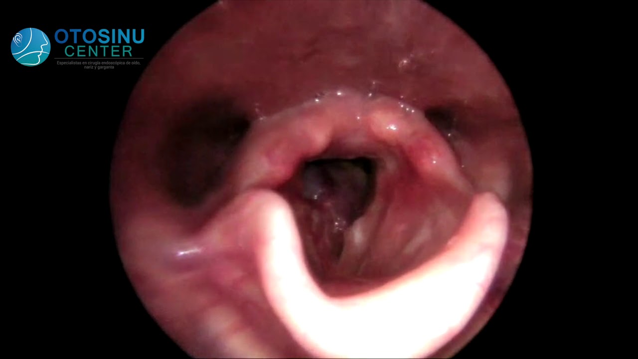 Walter Florez Guerra-17