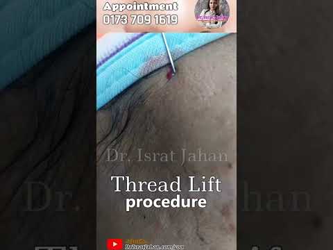 Korean V-shaped V-shape V-shape face Botox thread lift filler dr. Israt Jahan best dermatologist