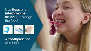 Doleski & Wolford Orthodontics | Ortho Education | Emergencies and Soreness