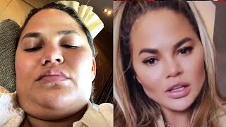 Chrissy Teigen Is Unrecognizable in New Photos—Is Ozempic to Blame