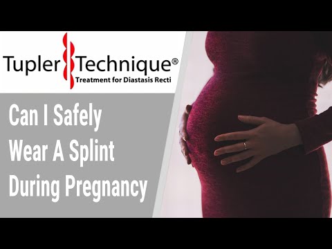 Can I Safely Wear A Splint During Pregnancy
