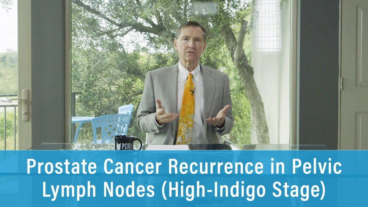 Prostate Cancer Recurrence in Pelvic Lymph Nodes (High-Indigo Stage) | Prostate Cancer Staging Guide