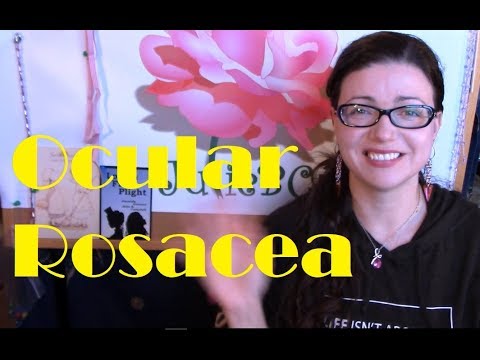 Everything I've Learned About Ocular Rosacea So Far | Rosy JulieBC