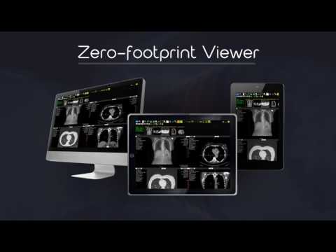Exa PACS Reviews and Pricing 2023