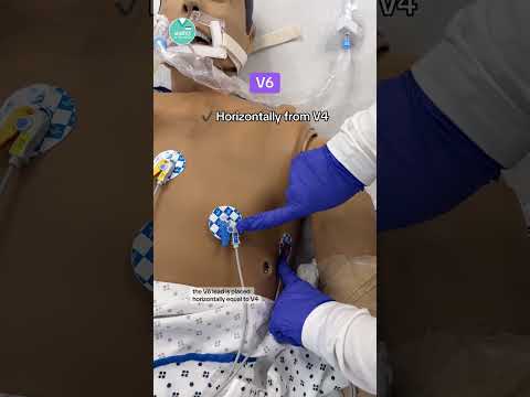 12-Lead EKG Placement