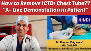 How to remove ICTD/ Chest Tube (HINDI) #Chest tube Extubation @Dr. Hemant K Agarwal
