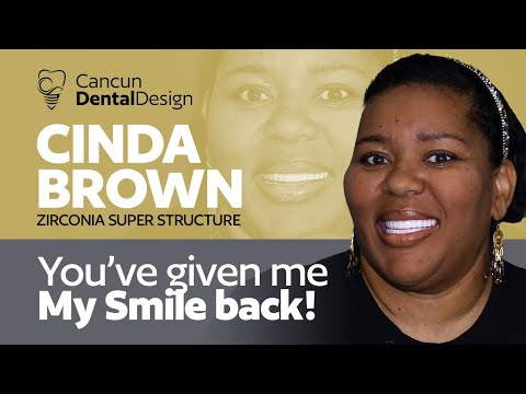 🍏Cinda's Dental Vacation & Life-Changing Smile at Cancun Dental Design 🏝️