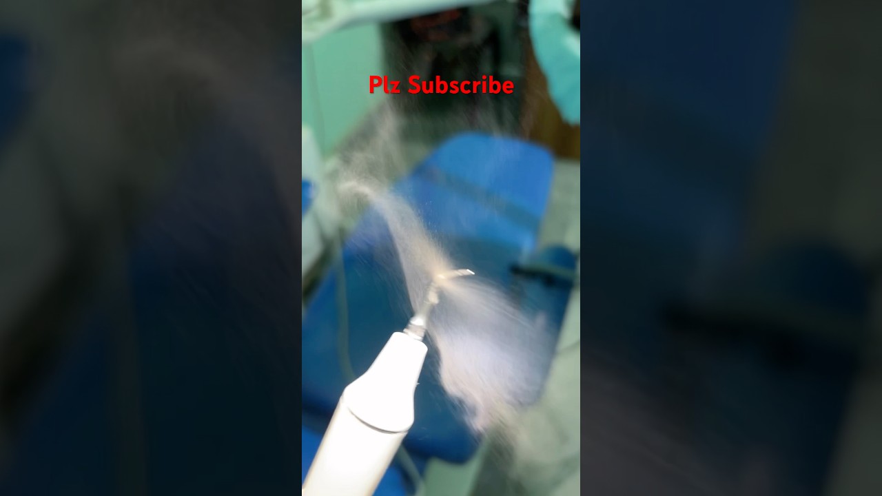 Ultrasonic Scaler #dentist #dentalhealth #vlog #dentalclinic #doctor #dentalartistry  #dentistry