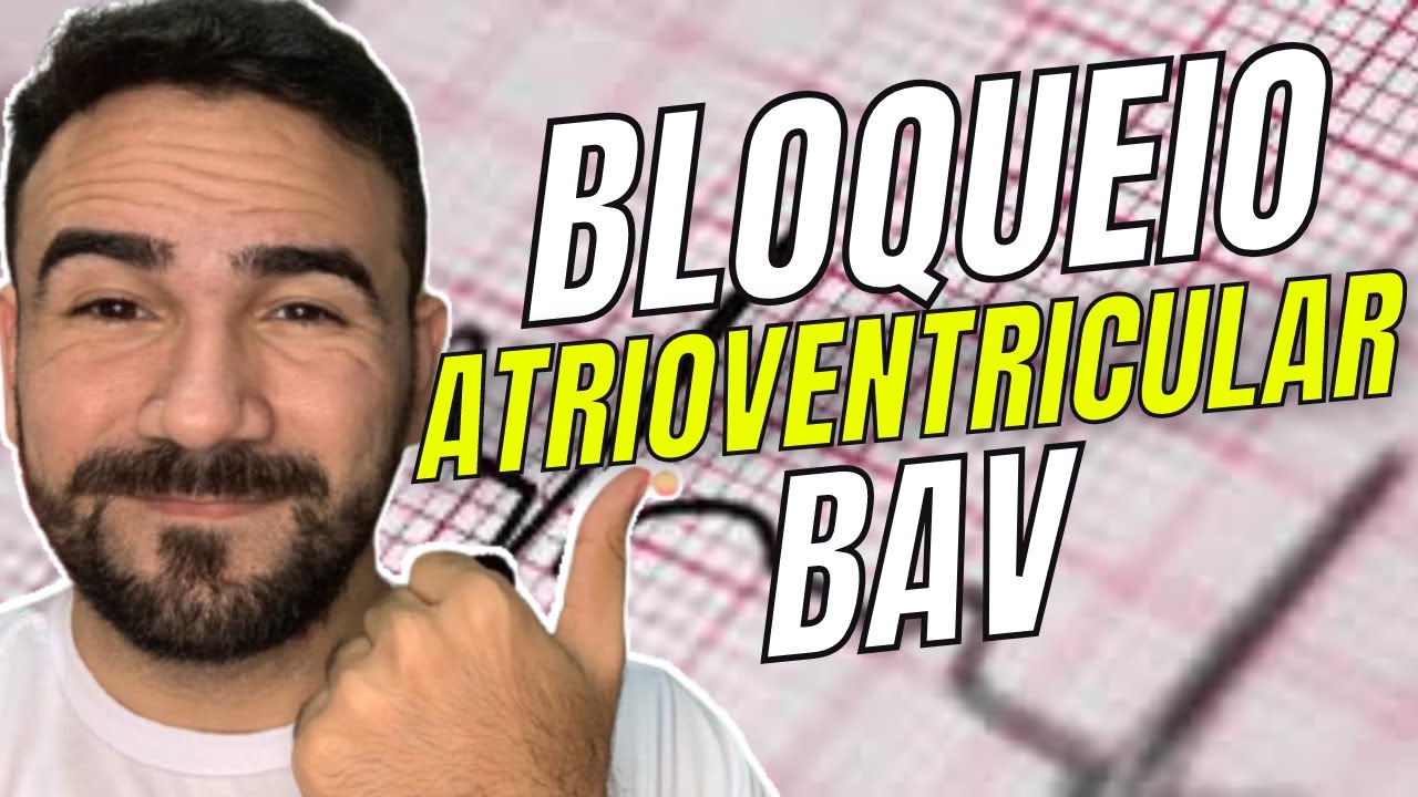 BLOQUEIO ATRIVENTRICULAR (BAV) - AULA COMPLETA