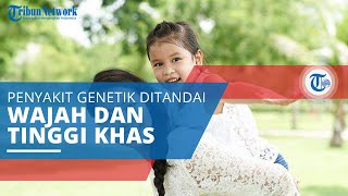 Sindrom Noonan, Salah Satu Penyakit Genetik yang Ditandai dengan Karakteristik Wajah yang Khas